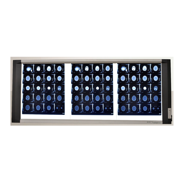 X-501 X-Ray